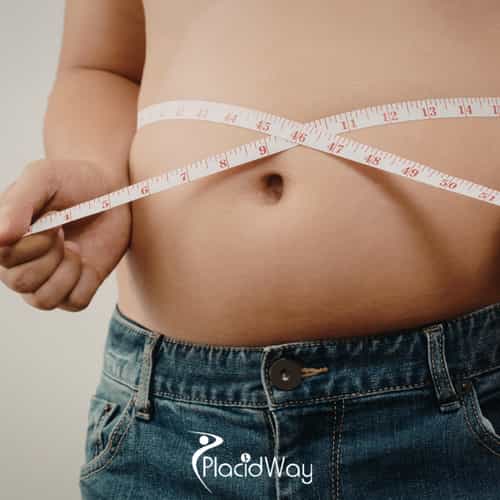 7 Reasons US Patients Choose Single-Incision Gastric Sleeve in Tijuana for Faster Recovery